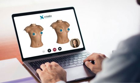Simulation 3D pour augmentation mammaire par prothèses, à Lyon